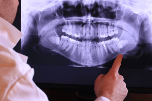 Best Dentist for Severe Toothache  in Red Wing, MN
