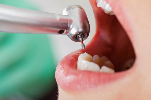 Best Dentist for Dental Trauma  in Red Wing, MN